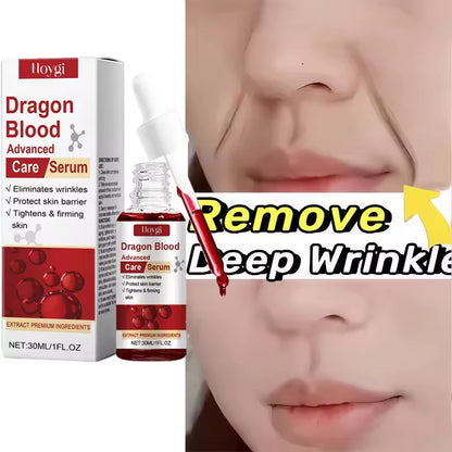 HOYGI Dragon Blood Advanced Care Serum