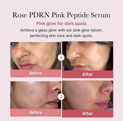 Medicube Rose PDRN Pink Peptide Serum