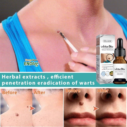 Eelhoe Active Skin Mole Reduce Serum Spot-10ml