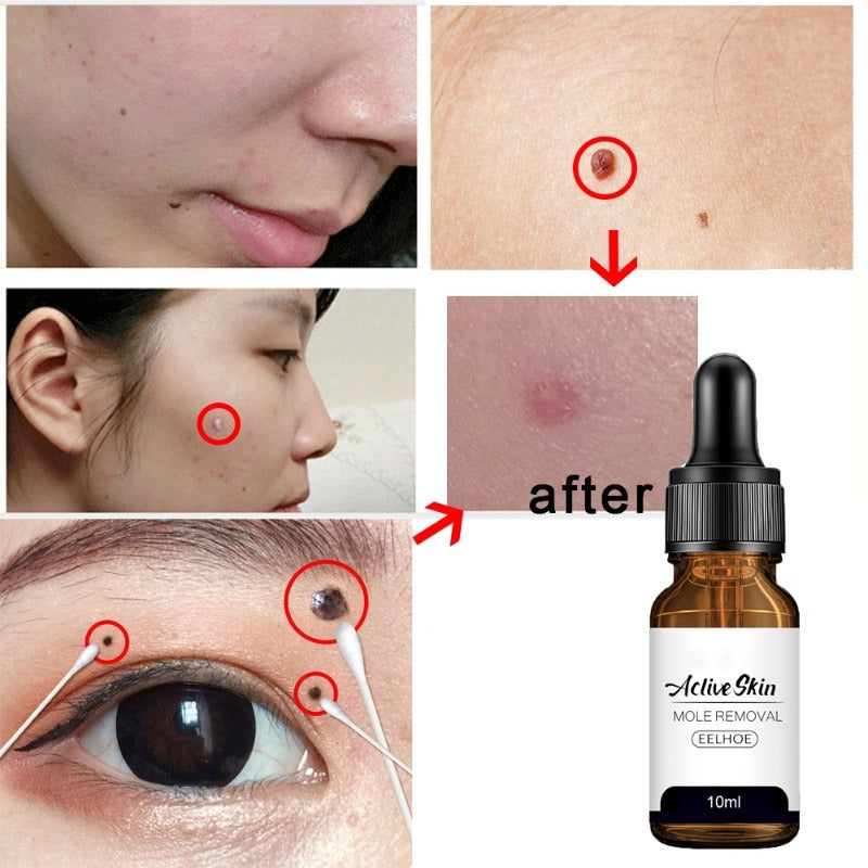 Eelhoe Active Skin Mole Reduce Serum Spot-10ml