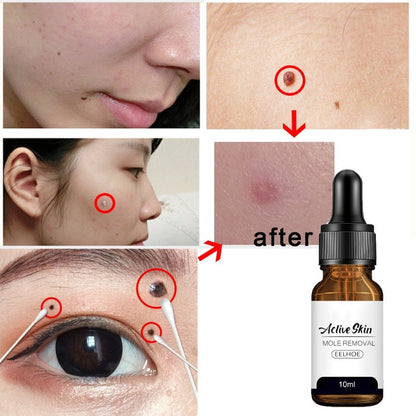 Eelhoe Active Skin Mole Reduce Serum Spot-10ml