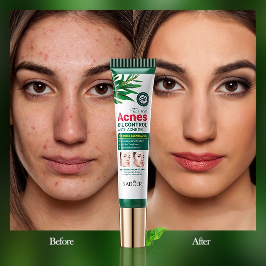 SADOER Tea Tree Oil Control Anti‑Acnes Gel (20 g)