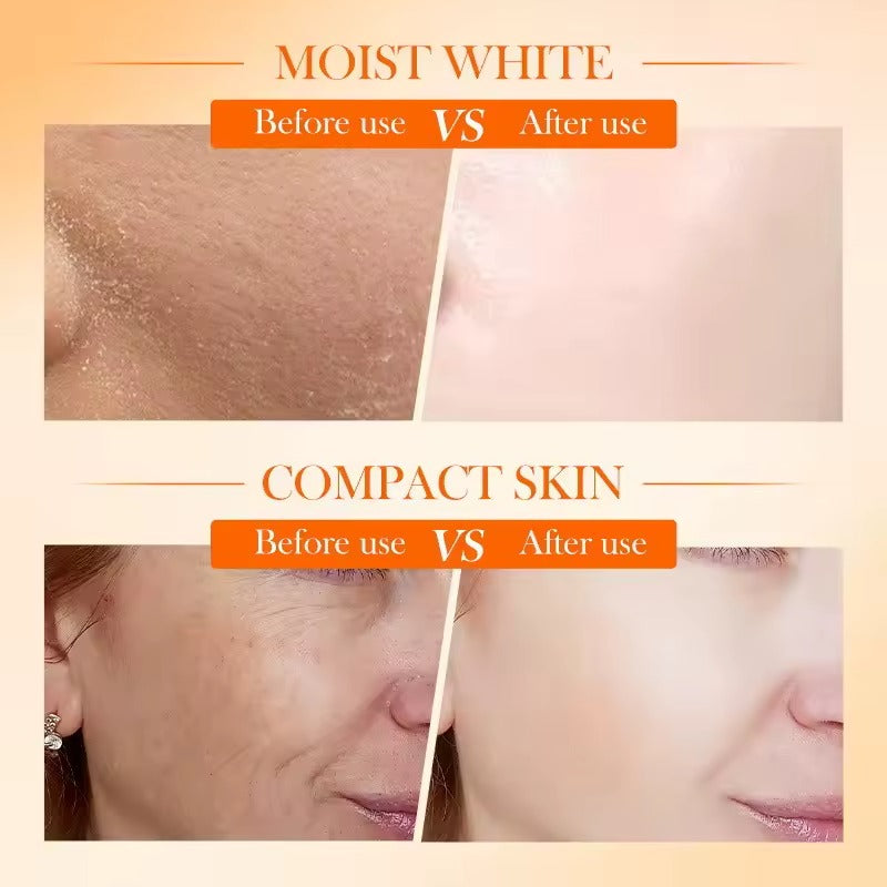 SADOER 5x Vitamin C Whitening Firming Cream