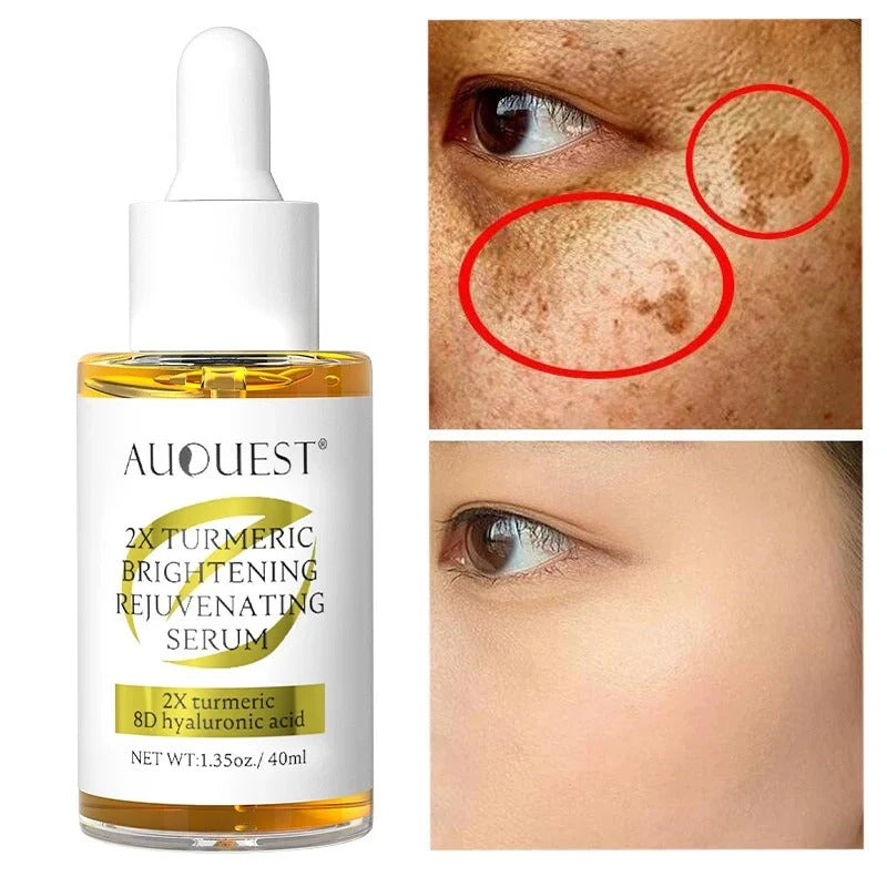 AUQUEST 2X Turmeric Brightening & Rejuvenating Serum – Glow Naturally, Every Day*