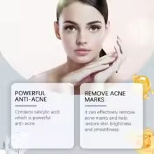 OUHOE 2% Salicylic Acid Serum – Clear Pores, Smooth Skin