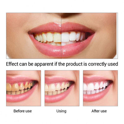 LANBENA professional teeth whitening essence liquid