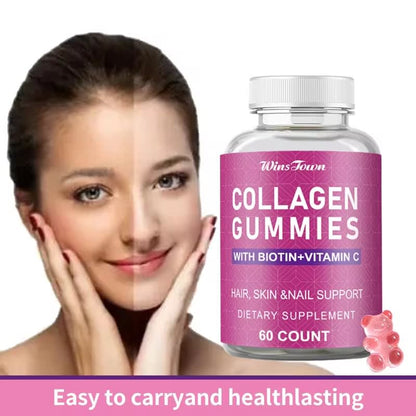 WINS TOWN Hot Sales Private label Beauty Skin Care Collagen Vitamin Gummy Supplement for Hair Skin and Nails Healthcare