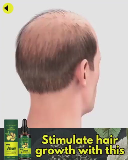 KING OF GINGER 7 days ginger hair growth stimulator, anti-breakage and hair loss treatment oil organic germinal serum 1