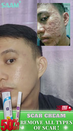 🔥ORIGINAL Saam Renewal Face Cream with QR CODE , BUY 1 GET 1 EXTRA FREE 🔥