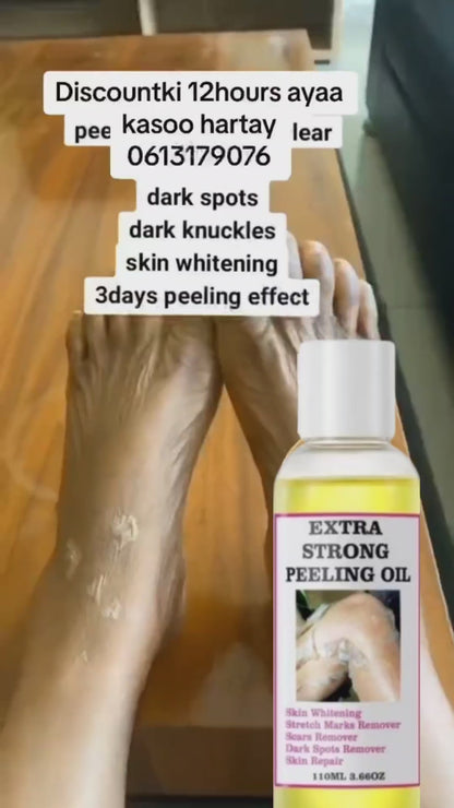 O'Carly Extra Strong Peeling Oil Exfolioating Yellow Peeling Oil for Dark Skin.