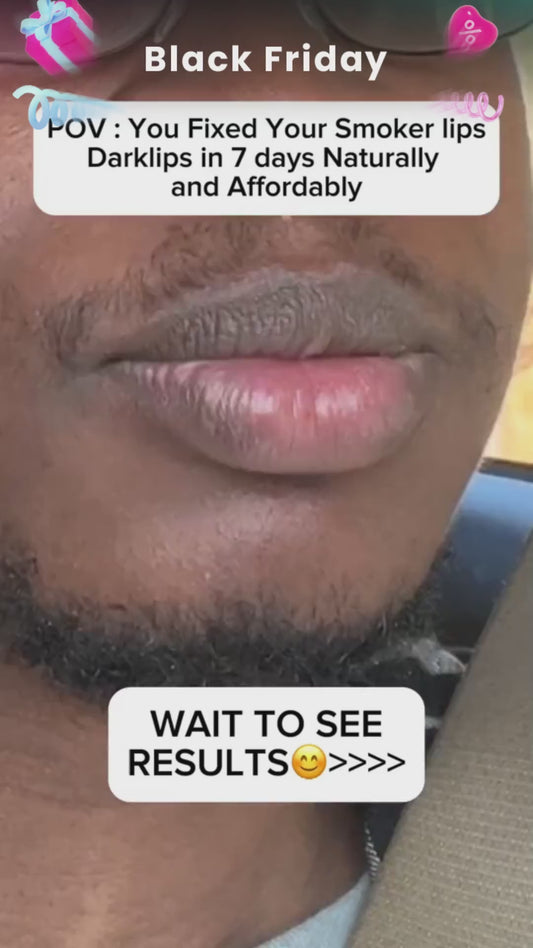 EELHOE Lip Lightening Cream (30 g)