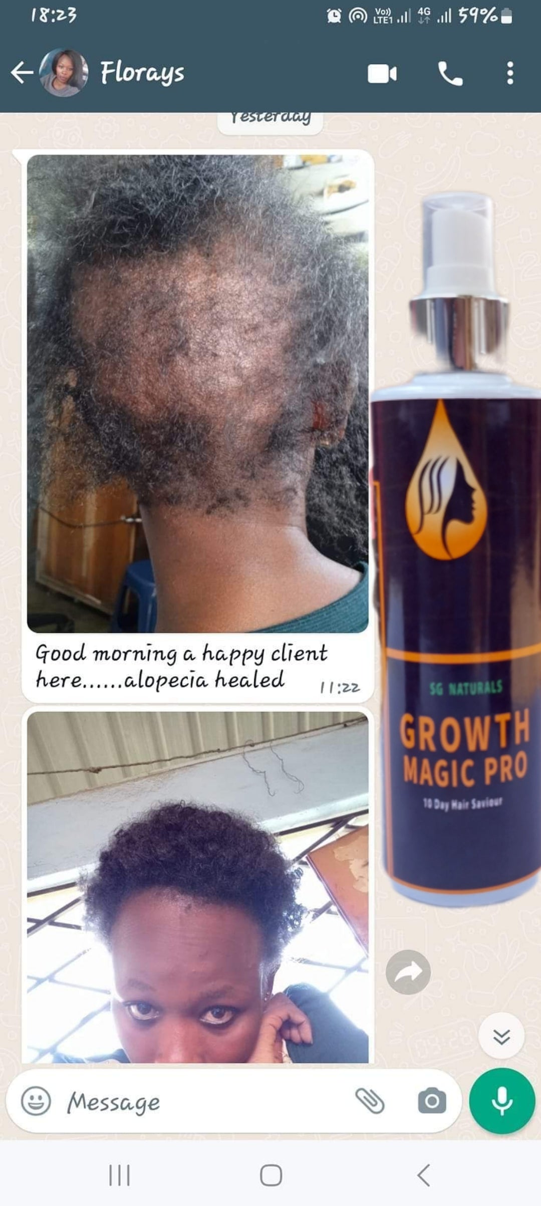 SG Naturals Growth Magic Pro 10 Days Hair Saviour 3