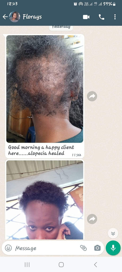 SG Naturals Growth Magic Pro 10 Days Hair Saviour 3