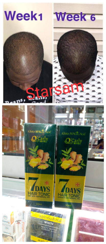 KING OF GINGER 7 days ginger hair growth stimulator, anti-breakage and hair loss treatment oil organic germinal serum 1