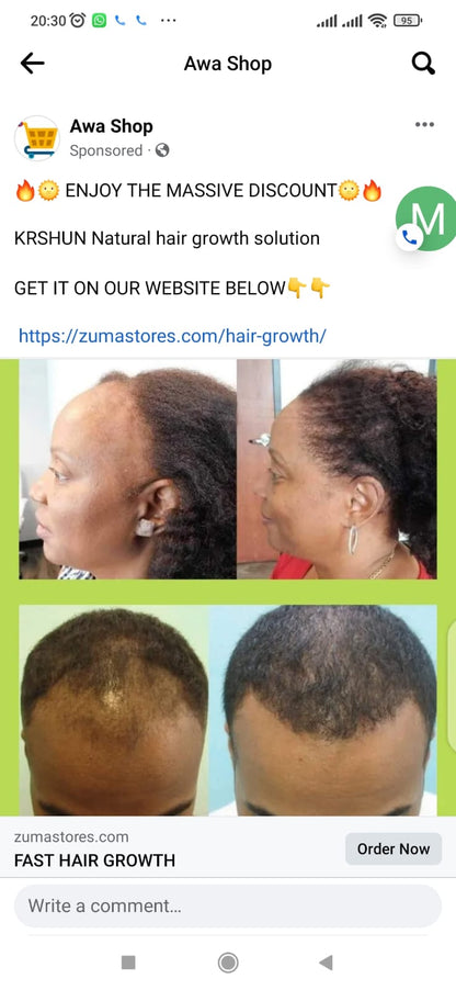 SG Naturals Growth Magic Pro 10 Days Hair Saviour 3