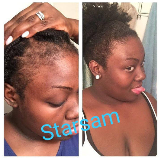 First Class Hair Booster 1