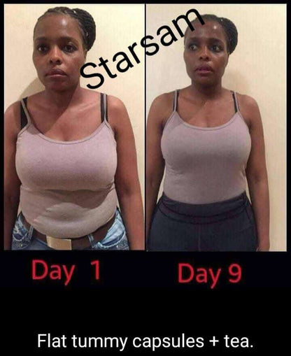 SG NATURALS Holistic Fat Burner Tea