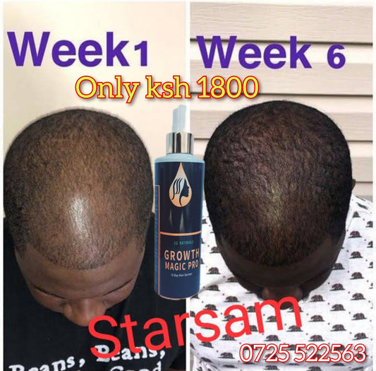 SG Naturals Growth Magic Pro 10 Days Hair Saviour 2