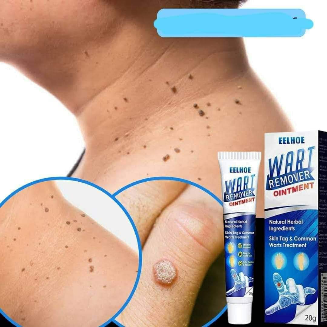 Sumifun Wart Remover Ointment 20g