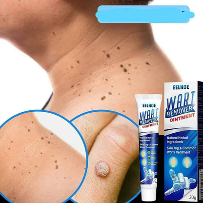 Sumifun Wart Remover Ointment 20g