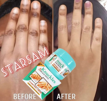 Skin Beauty Knuckles Elbow Knee Toes Black Spot Cream