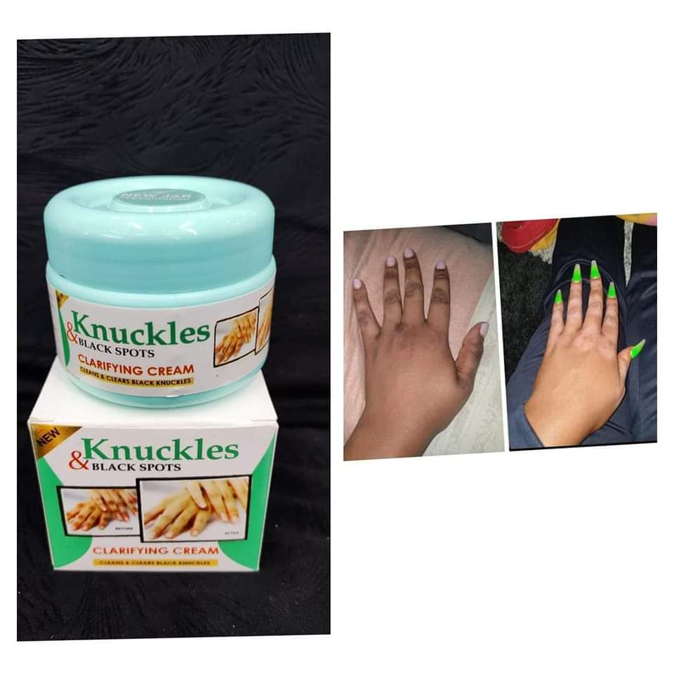 Skin Beauty Black Spot Cream | Erase Dark Knuckles & Elbows ✨ Skin Beauty Black Spot Cream — Fade Dark Knuckles, Elbows & Knees Fast | Clinically Proven Results | Save KSh 25%!Fast | LIMITED STOCK + Surprise Gift! - SAVE KSh 300 TODAY