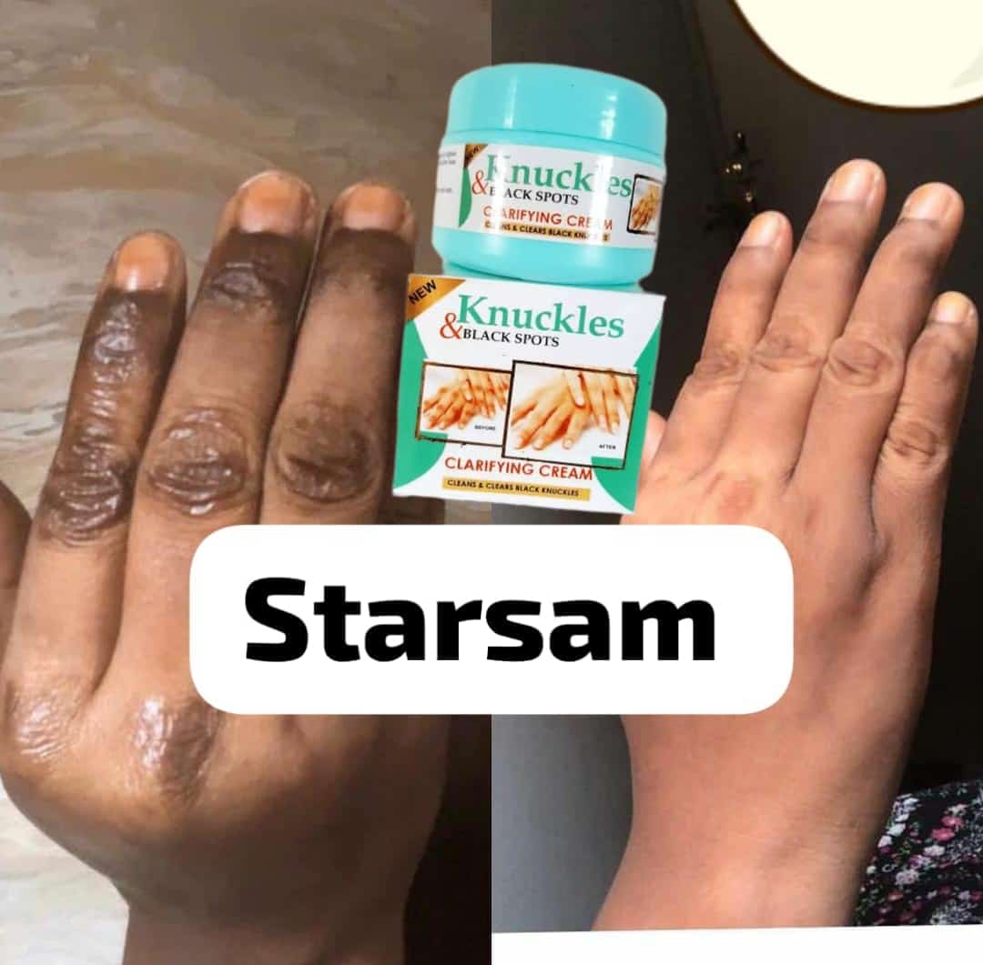 Skin Beauty Knuckles Elbow Knee Toes Black Spot Cream