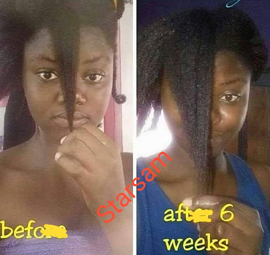 First Class Hair Booster 2