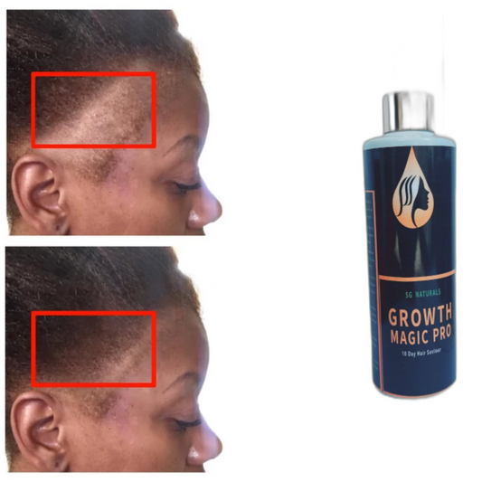 SG Naturals Growth Magic Pro 10 Days Hair Saviour 3