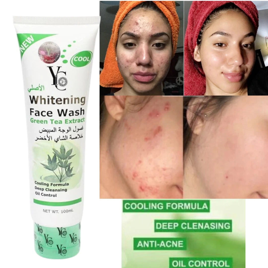 YC Whitening Face Wash for Oily Skin with Green Tea – 100ml