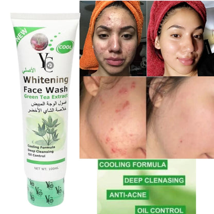 YC Whitening Face Wash for Oily Skin with Green Tea – 100ml