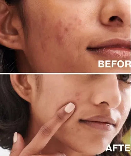 YC Whitening Face Wash for Oily Skin with Green Tea – 100ml