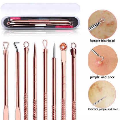 4pcs Blackhead Remover Kit – Stainless Steel Acne & Pimple Extractor Set