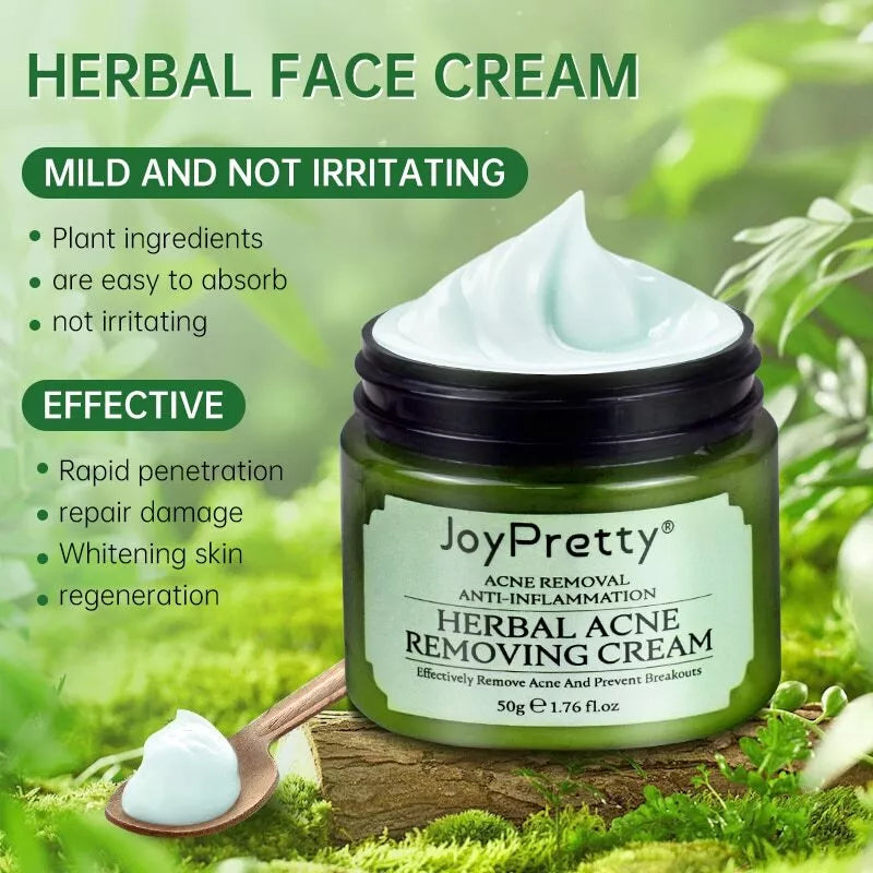 JOY PRETTY Herbal EXTRACTS ACNE REMOVING CREAM + FREE EYE LINER